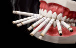 Можно ли после удаления зуба курить сигареты
