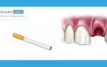 Можно ли курить при удалении зуба