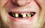 Как курение влияет на зубы