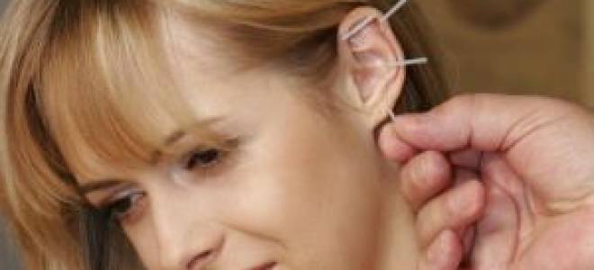 Иглоукалывание чтобы бросить курить