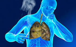 Как лечить кашель курильщика медикаментозно