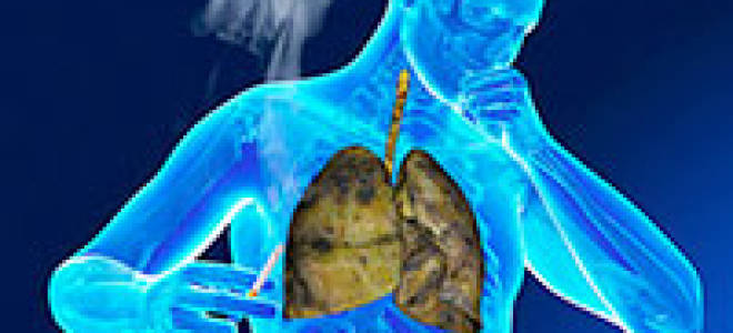 Кашель курильщика лечение таблетки какие лучше