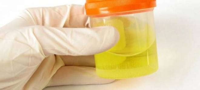 Можно ли найти никотин в моче