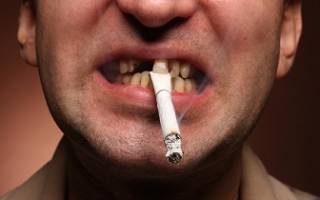 Сколько нельзя курить после удаления зуба