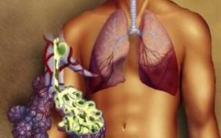 Можно ли курить при пневмонии легких отзывы