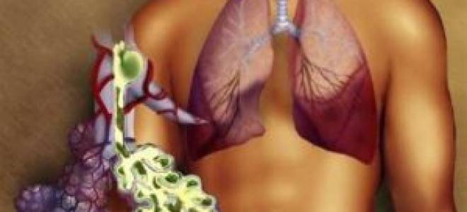 Можно ли курить при пневмонии легких отзывы