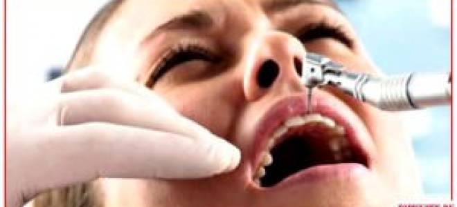 Бросил курить начали болеть зубы