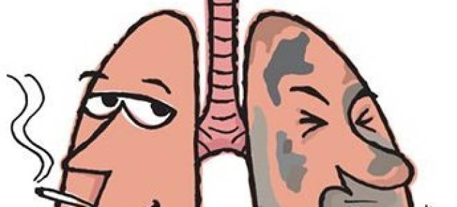 Лекарство от бронхита курильщика